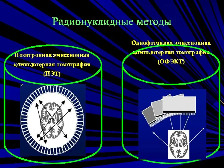 Радионуклидные методы Позитронная эмиссионная компьютерная томография (ПЭТ) Однофотонная эмиссионная компьютерная томография (ОФЭКТ)