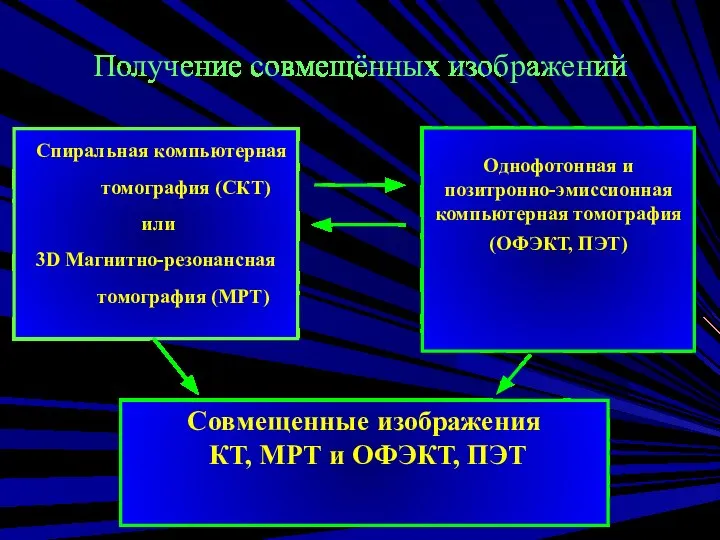 Получение совмещённых изображений Спиральная компьютерная томография (СКТ) или 3D Магнитно-резонансная томография