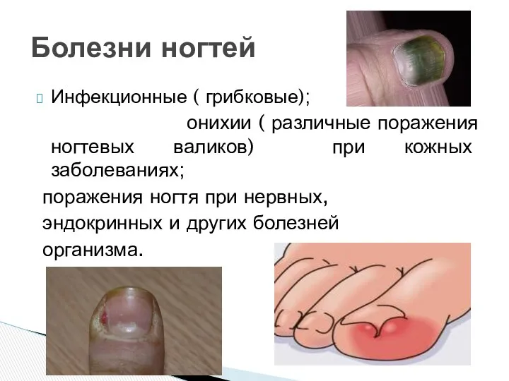 Инфекционные ( грибковые); онихии ( различные поражения ногтевых валиков) при кожных