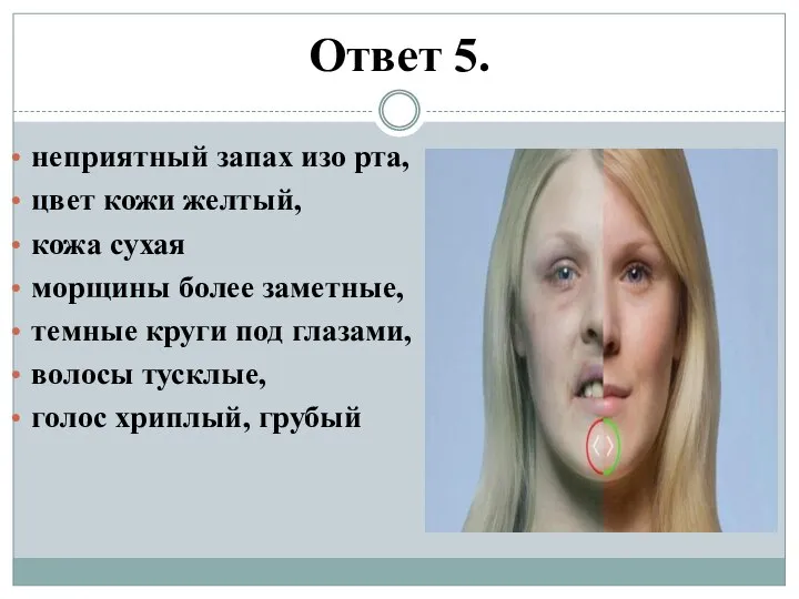 Ответ 5. неприятный запах изо рта, цвет кожи желтый, кожа сухая