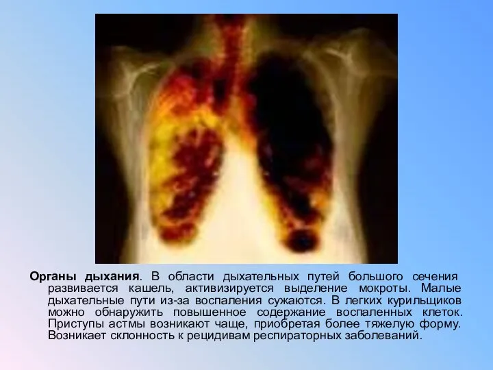 Органы дыхания. В области дыхательных путей большого сечения развивается кашель, активизируется