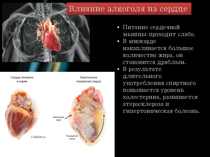 Питание сердечной мышцы проходит слабо. В миокарде накапливается большое количество жира,