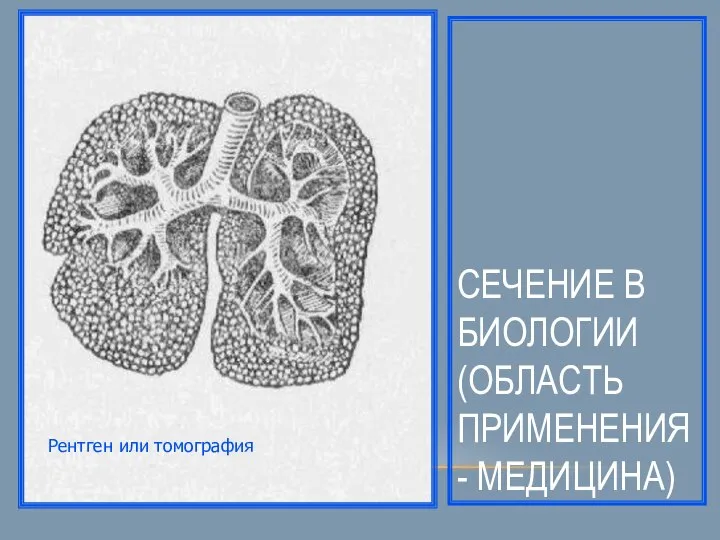 СЕЧЕНИЕ В БИОЛОГИИ (ОБЛАСТЬ ПРИМЕНЕНИЯ- МЕДИЦИНА) Рентген или томография