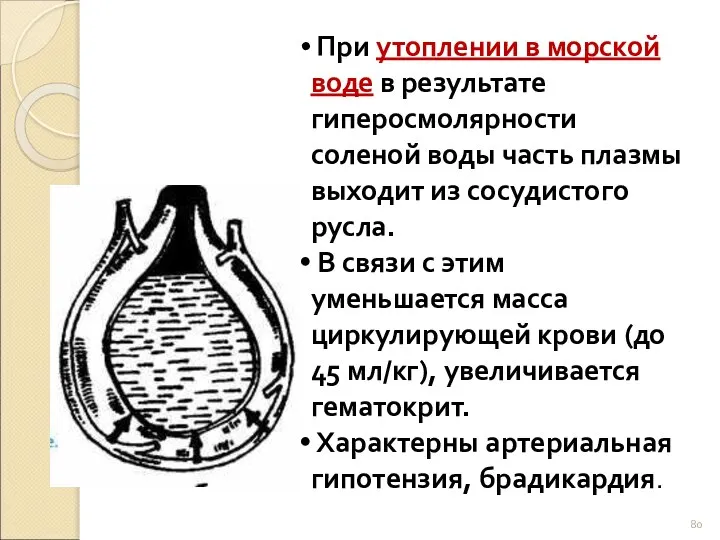 При утоплении в морской воде в результате гиперосмолярности соленой воды часть