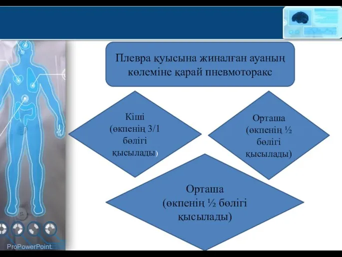 Плевра қуысына жиналған ауаның көлеміне қарай пневмоторакс Орташа (өкпенің ½ бөлігі