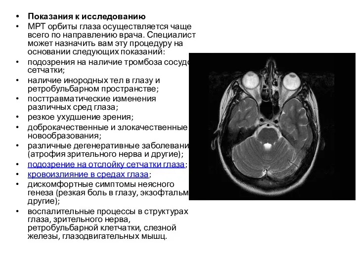 Показания к исследованию МРТ орбиты глаза осуществляется чаще всего по направлению