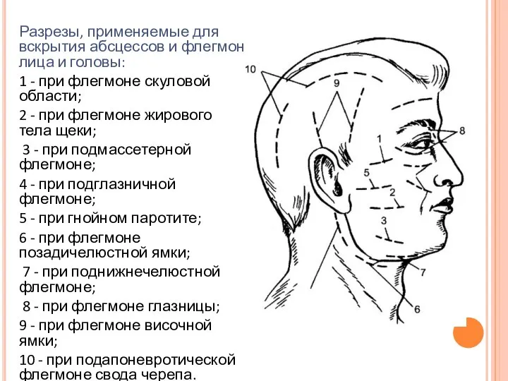 Разрезы, применяемые для вскрытия абсцессов и флегмон лица и головы: 1