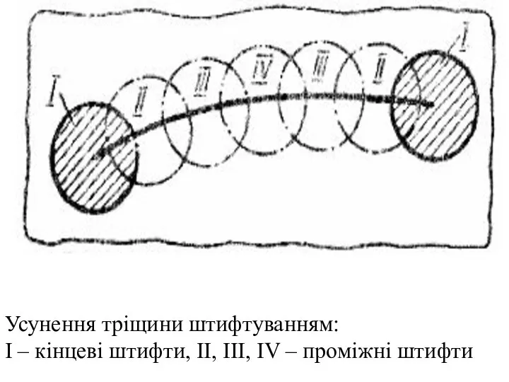 Усунення тріщини штифтуванням: І – кінцеві штифти, ІІ, ІІІ, IV – проміжні штифти