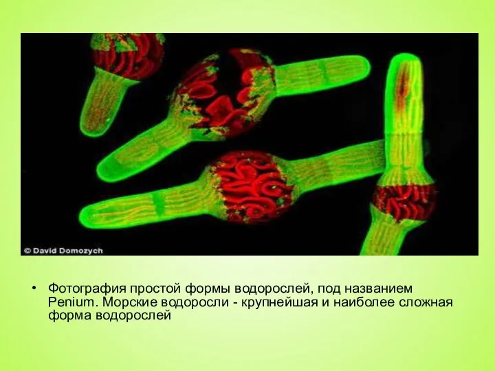 Фотография простой формы водорослей, под названием Penium. Морские водоросли - крупнейшая и наиболее сложная форма водорослей