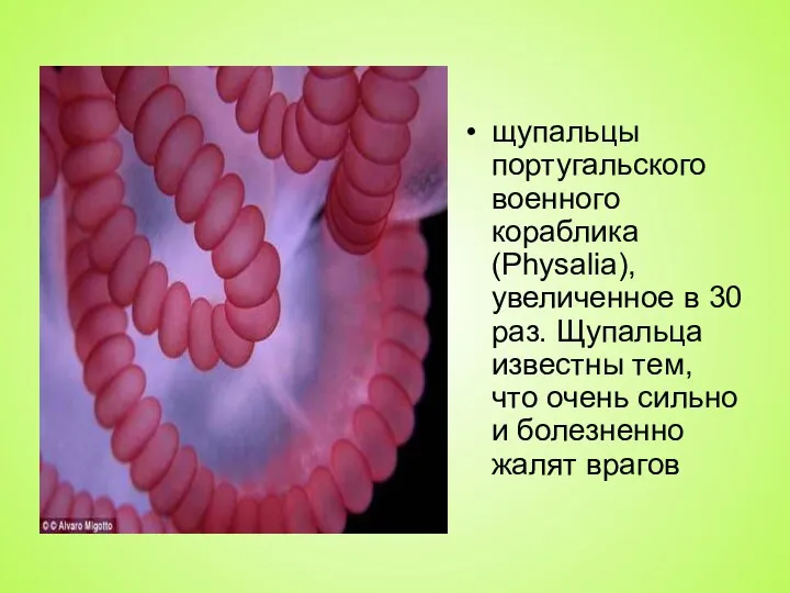 щупальцы португальского военного кораблика (Physalia), увеличенное в 30 раз. Щупальца известны