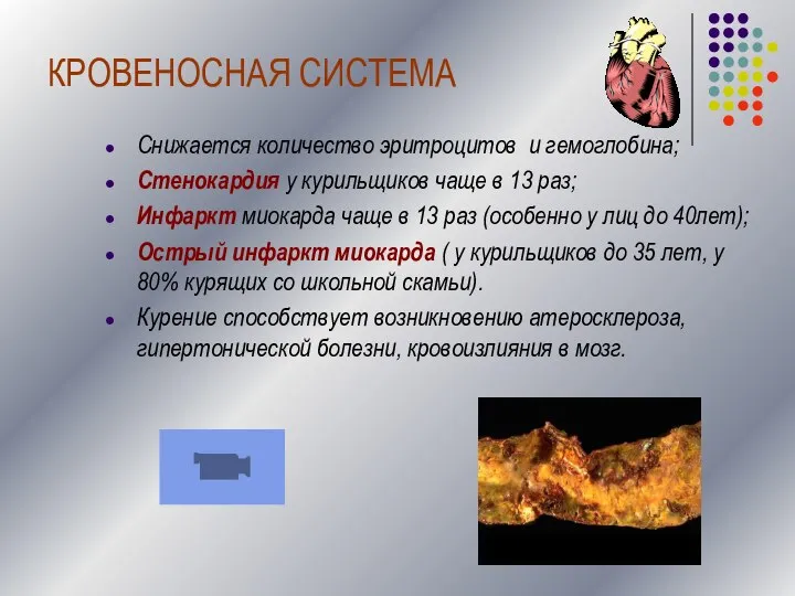 КРОВЕНОСНАЯ СИСТЕМА Снижается количество эритроцитов и гемоглобина; Стенокардия у курильщиков чаще