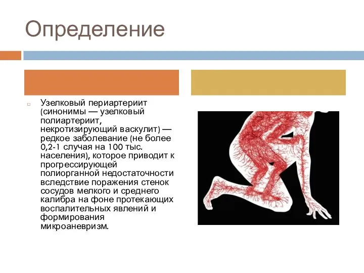 Определение Узелковый периартериит (синонимы — узелковый полиартериит, некротизирующий васкулит) — редкое