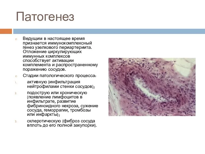 Патогенез Ведущим в настоящее время признается иммунокомплексный генез узелкового периартериита. Отложение