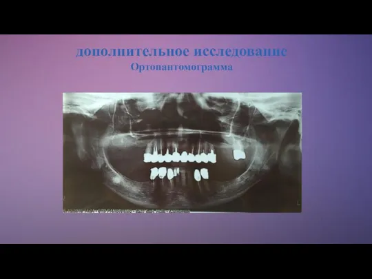 дополнительное исследование Ортопантомограмма