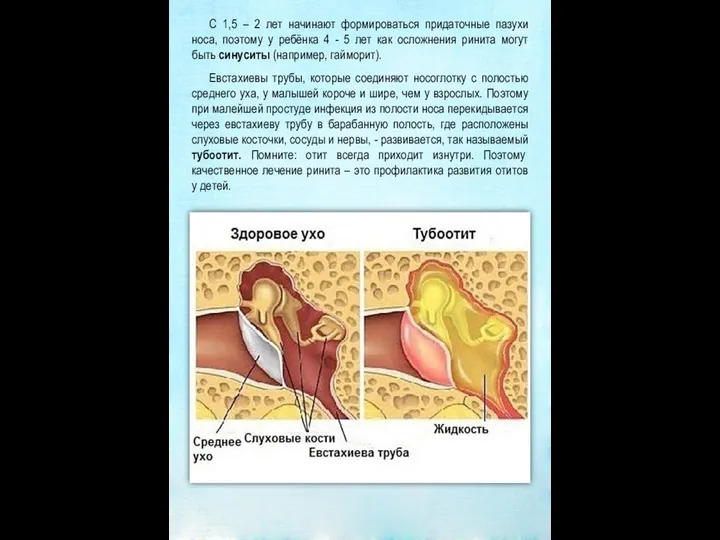 С 1,5 – 2 лет начинают формироваться придаточные пазухи носа, поэтому