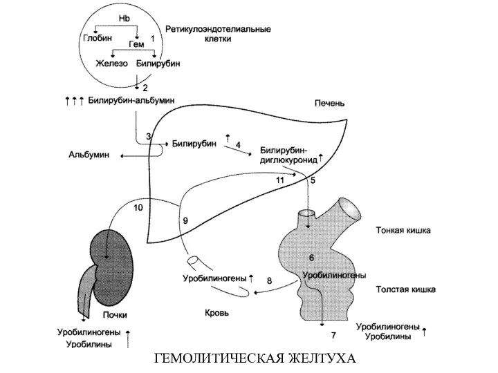 ГЕМОЛИТИЧЕСКАЯ ЖЕЛТУХА