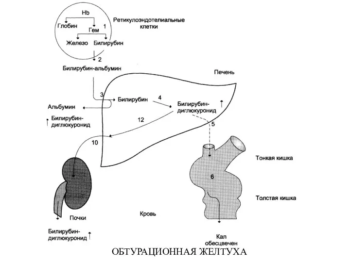 ОБТУРАЦИОННАЯ ЖЕЛТУХА