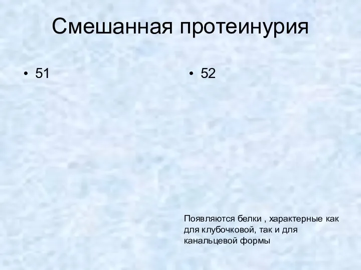 Смешанная протеинурия 51 52 Появляются белки , характерные как для клубочковой, так и для канальцевой формы