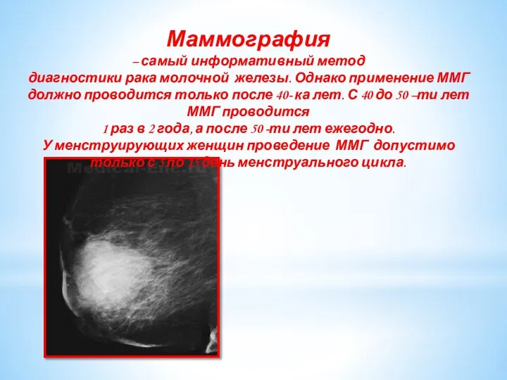 Маммография – самый информативный метод диагностики рака молочной железы. Однако применение