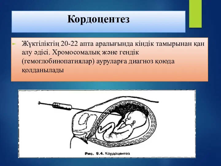 Кордоцентез Жүктіліктің 20-22 апта аралығында кіндік тамырынан қан алу әдісі. Хромосомалық