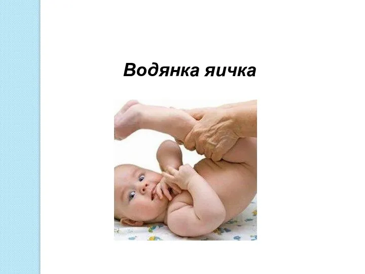 Водянка яичка