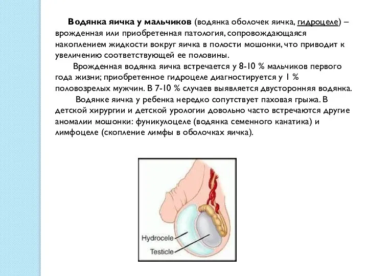 Водянка яичка у мальчиков (водянка оболочек яичка, гидроцеле) – врожденная или