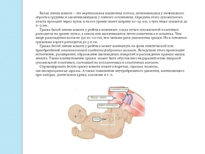 Белая линия живота – это вертикальная мышечная полоса, начинающаяся у мечевидного