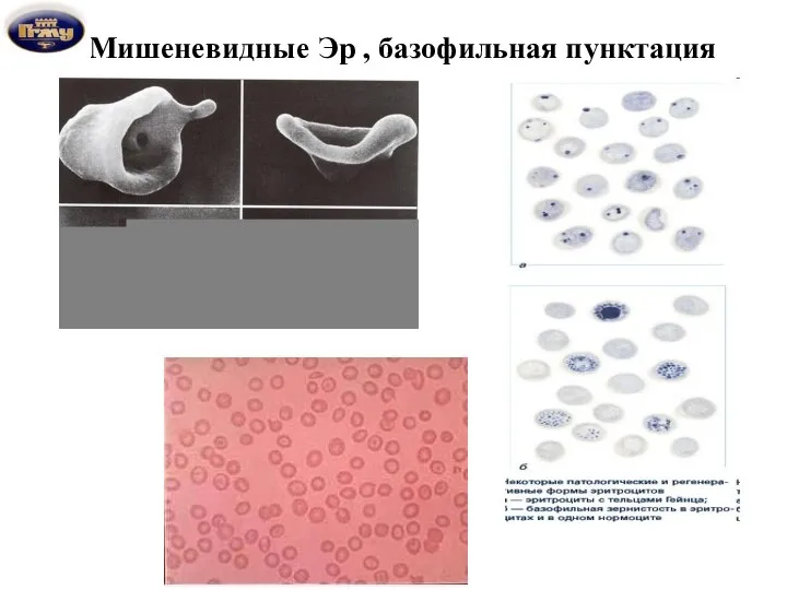 Мишеневидные Эр , базофильная пунктация