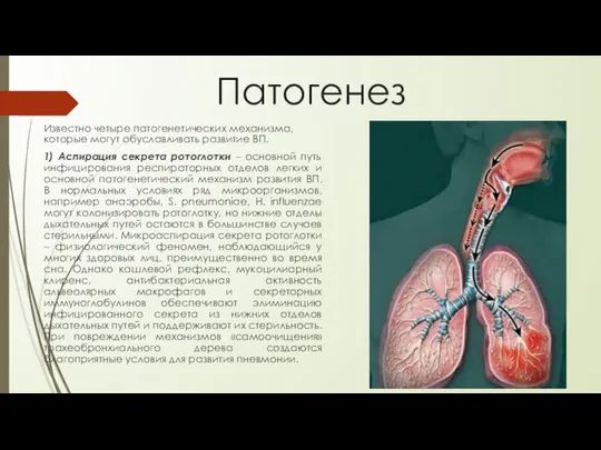 Патогенез Известно четыре патогенетических механизма, которые могут обуславливать развитие ВП. 1)