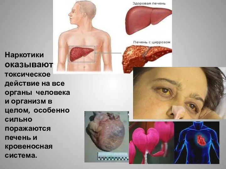 Наркотики оказывают токсическое действие на все органы человека и организм в