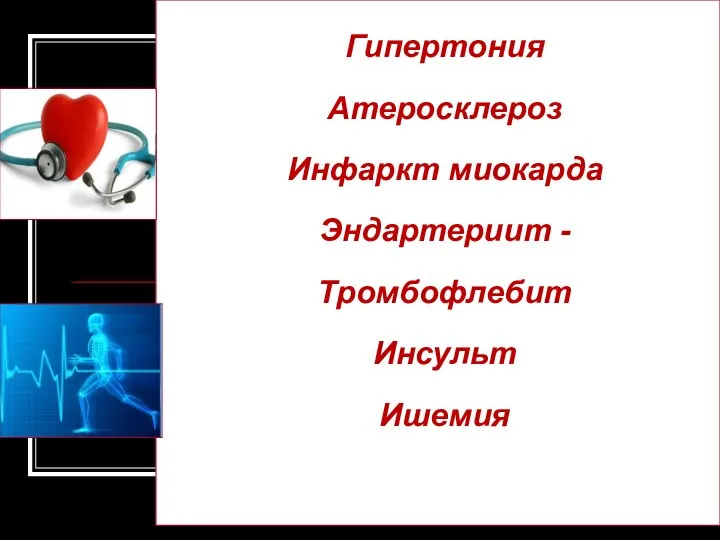 Гипертония Атеросклероз Инфаркт миокарда Эндартериит - Тромбофлебит Инсульт Ишемия