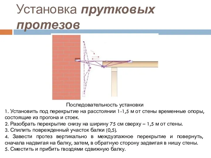 Установка прутковых протезов Последовательность установки 1. Установить под перекрытие на расстоянии