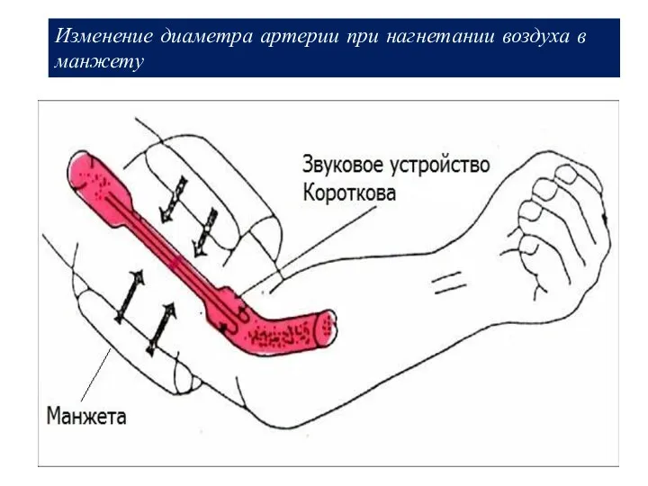 Изменение диаметра артерии при нагнетании воздуха в манжету