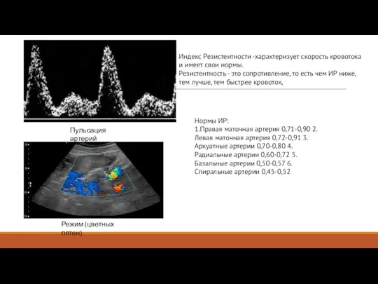 Режим (цветных пятен) Пульсация артерий Индекс Резистентности -характеризует скорость кровотока и