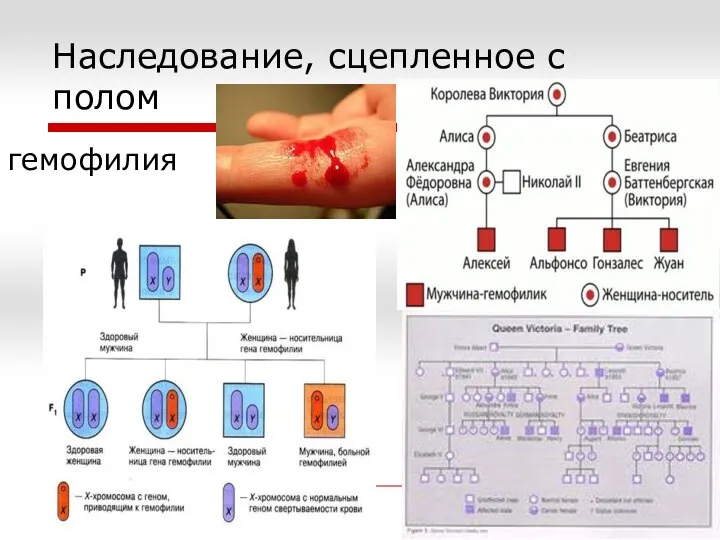 Наследование, сцепленное с полом гемофилия