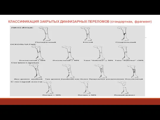 КЛАССИФИКАЦИЯ ЗАКРЫТЫХ ДИАФИЗАРНЫХ ПЕРЕЛОМОВ (стандартная, фрагмент)