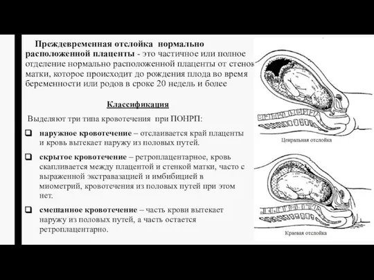 Преждевременная отслойка нормально расположенной плаценты - это частичное или полное отделение