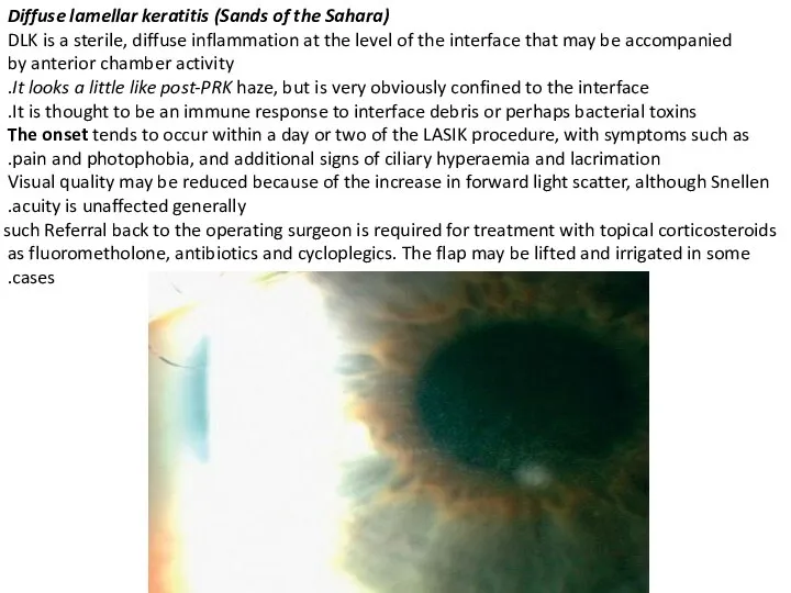 Diffuse lamellar keratitis (Sands of the Sahara) DLK is a sterile,