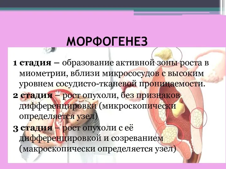 МОРФОГЕНЕЗ 1 стадия – образование активной зоны роста в миометрии, вблизи