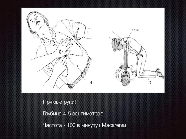 Прямые руки! Глубина 4-5 сантиметров Частота - 100 в минуту ( Macarena)