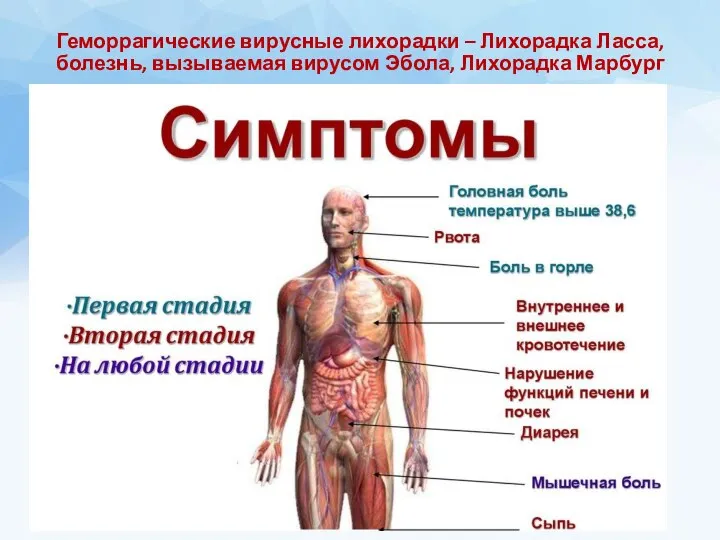 Геморрагические вирусные лихорадки – Лихорадка Ласса, болезнь, вызываемая вирусом Эбола, Лихорадка Марбург