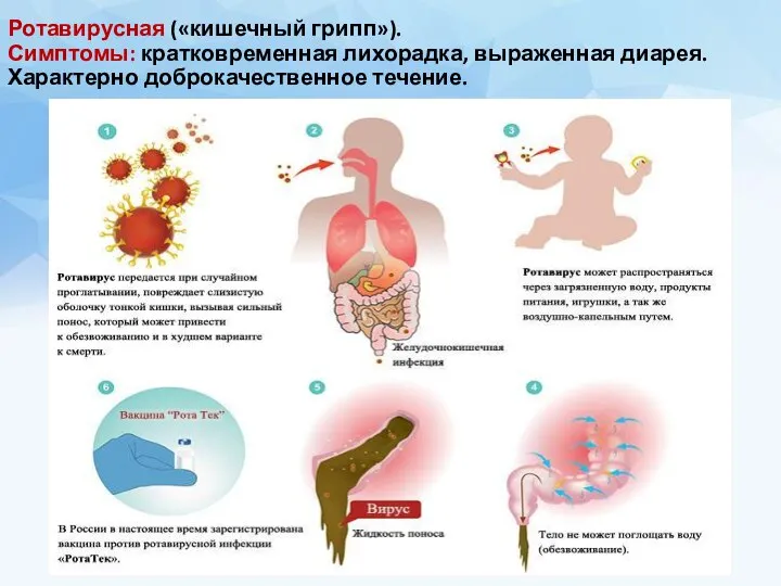 Ротавирусная («кишечный грипп»). Симптомы: кратковременная лихорадка, выраженная диарея. Характерно доброкачественное течение.