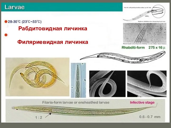 Рабдитовидная личинка Филяриевидная личинка