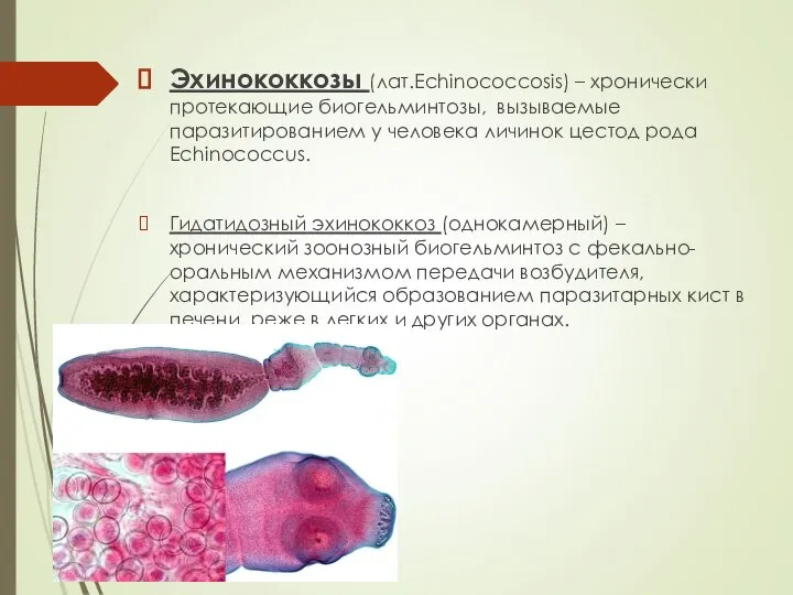 Эхинококкозы (лат.Echinococcosis) – хронически протекающие биогельминтозы, вызываемые паразитированием у человека личинок