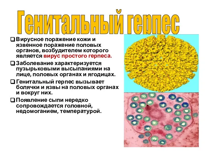 Вирусное поражение кожи и язвенное поражение половых органов, возбудителем которого является