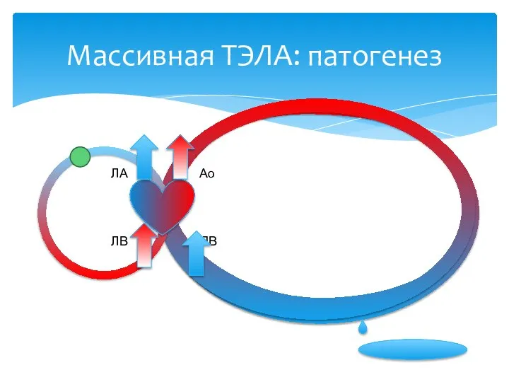 Ао ПВ ЛА ЛВ Массивная ТЭЛА: патогенез