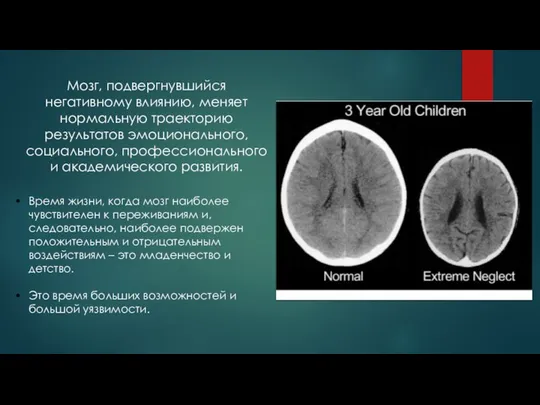 Мозг, подвергнувшийся негативному влиянию, меняет нормальную траекторию результатов эмоционального, социального, профессионального
