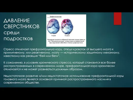 Стресс отключает префронтальную кору, отводя кровоток от высшего мозга к примитивному,