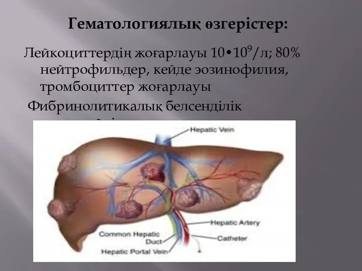 Гематологиялық өзгерістер: Лейкоциттердің жоғарлауы 10•109/л; 80% нейтрофильдер, кейде эозинофилия, тромбоциттер жоғарлауы Фибринолитикалық белсенділік төмендейді.