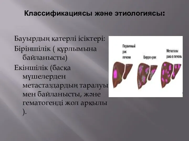 Классификациясы және этиологиясы: Бауырдың қатерлі ісіктері: Біріншілік ( құрлымына байланысты) Екіншілік